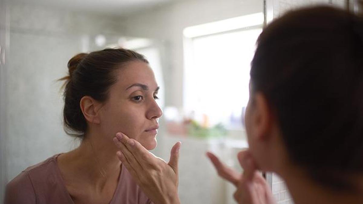 What is ‘ferritin face’ and why is this health scare trending on social media?